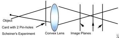 Presbyopia - Cause and Treatment: Overview, Helmholtz Theory of ...