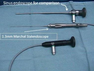 Comparison of 1.3-mm Marchal sialendoscope with st