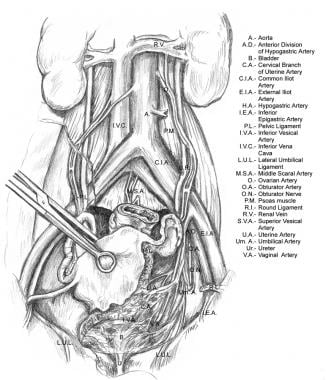 Vasculature of female pelvis. 