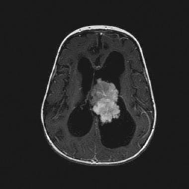 Axial T1-weighted contrast-enhanced magnetic reson
