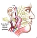 Facial Nerve Monitors