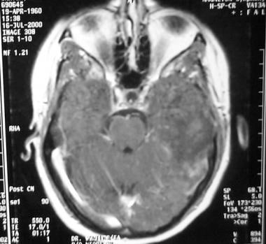 Contrast-enhanced magnetic resonance imaging (MRI)