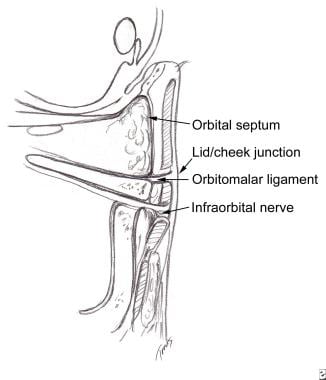 Cross sectional anatomy of the lid-cheek junction.