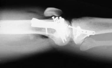 Radiograph of the leg. 