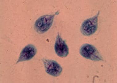 Giardiasis. Giardia lamblia trophozoites in cultur