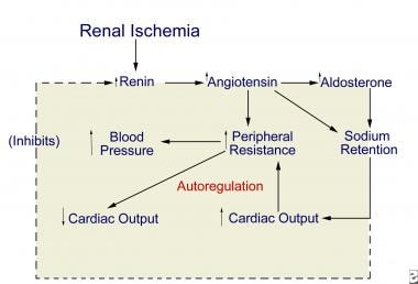 Proposed pathogenesis of renovascular hypertension