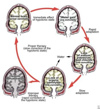 Assessment of neuroendocrine dysfunction following traumatic brain injury.