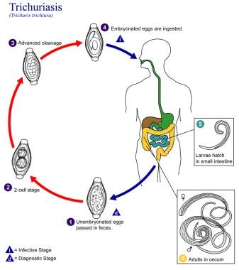 This is an illustration of the life cycle of Trich