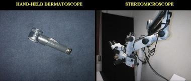 Hand-held dermatoscope and stereomicroscope. 