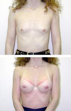 (Above) Preoperative view of 23-year-old patient w