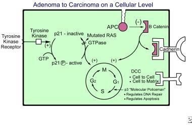 Adenoma-to-carcinoma sequence on a cellular level.
