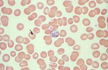A mature schizont within an erythrocyte. These red