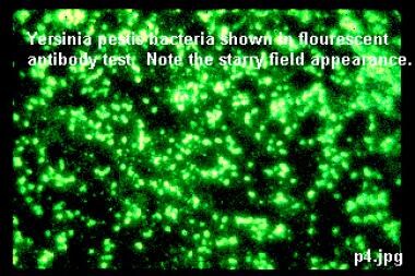 Yersinia pestis bacteria on fluorescent antibody t