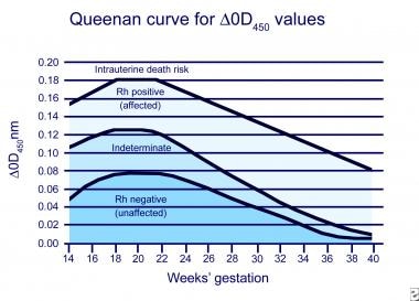 Queenan Curve: Modified Liley curve that shows del