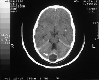 Axial, contrast-enhanced computed tomography (CT) 