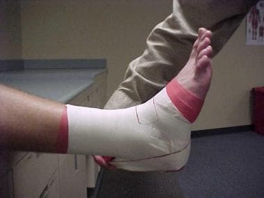 Ankle taping and bracing. Second step of lateral h
