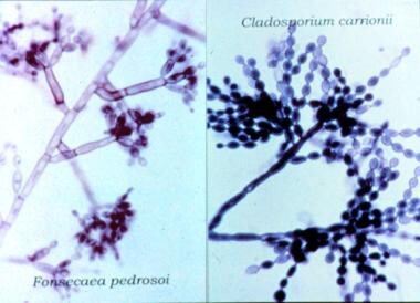 Micromorphology of Cladosporium carrionii (left) a