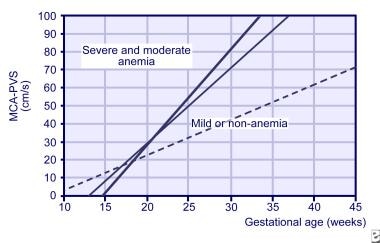 Mca Pi Chart