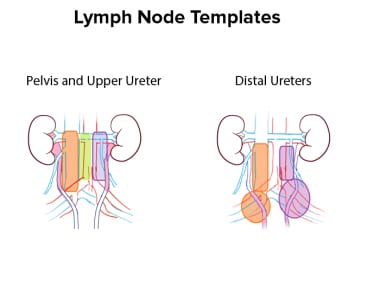 Graphic representation of templates for lymph node