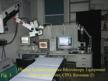 Digital epiluminescence microscopy equipment, Skin