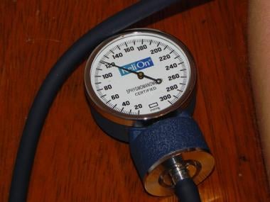 Aneroid sphygmomanometer at level of systolic bloo