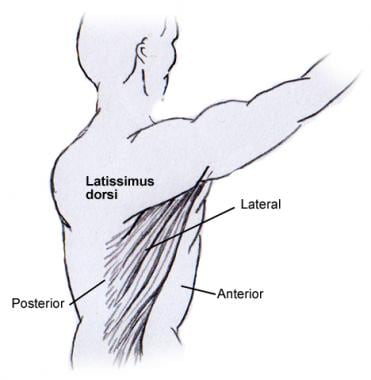 The latissimus dorsi muscle. The latissimus dorsi 