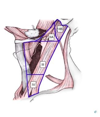 central neck dissection technique