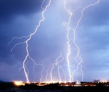 Cloud-to-ground lightning. Courtesy of Wikimedia C