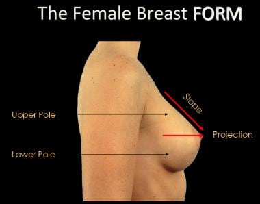 The female breast form. 