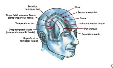 The fascial planes of the forehead and temple. The