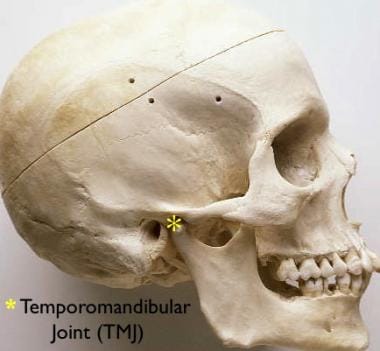 The temporomandibular joint. 