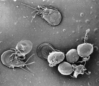 disease causing protozoa