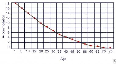 Age-related loss of accommodation. 