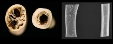 Cross-section of a bird (far left) and dog humerus