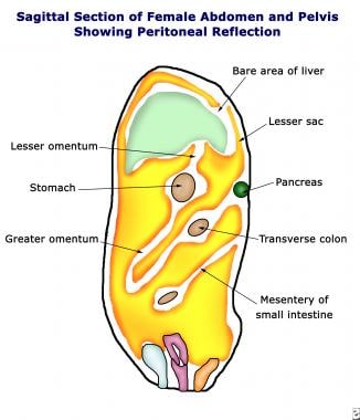 Pneumoperitoneum. Diagram of a sagittal section of