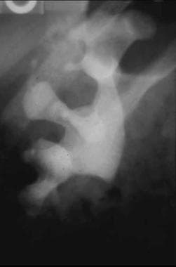 Patient with Acute Onset of Right Flank Pain - Manual of Medicine