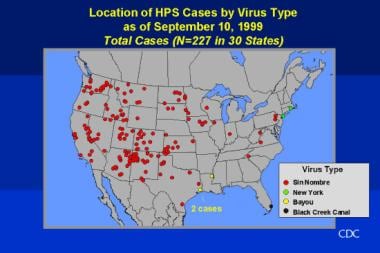 Hantavirus Cardiopulmonary Syndrome Hcps Background Pathophysiology Epidemiology