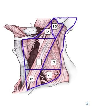 Selective neck dissection for posterior scalp and 