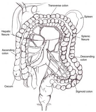 高级肠系膜动脉和劣质肠系膜