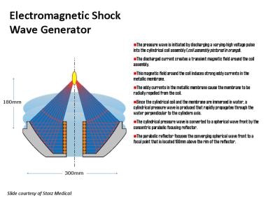 Electromagnetic generator system. 