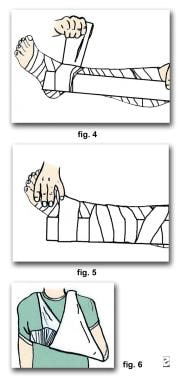 Sea Snake Envenomation Treatment & Management: Prehospital Care ...