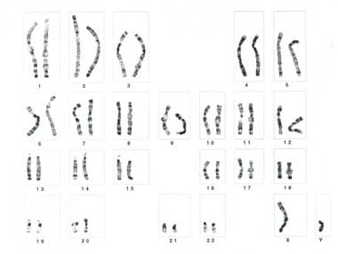 Prenatal Diagnosis for Congenital Malformations and Genetic