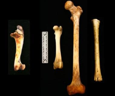 A lateral view of an immature pig humerus (left), 