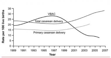 Vaginal birth after cesarean delivery rates.