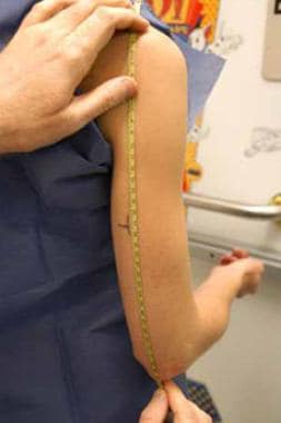 Upper arm length measurement and mid-arm mark. Cou