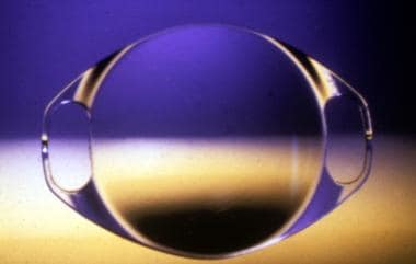 6-mm diameter optic, Artisan lens. Courtesy of Pro