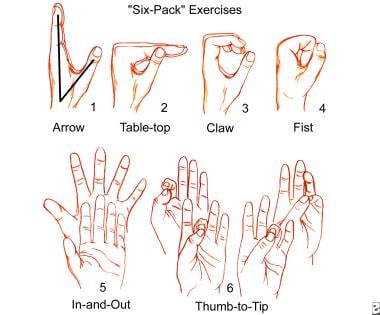 "Six-pack" exercises as Palmer describes, are perf