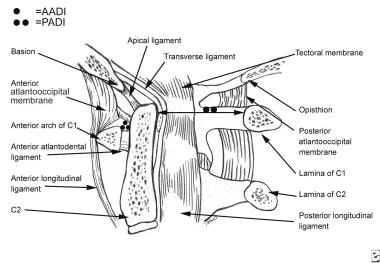 Midsagittal section of upper cervical spine. Note 