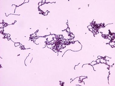 Picture of Streptococcus pyogenes at 100 X magnifi