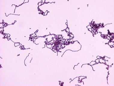 Scarlet Fever: Background, Pathophysiology, Etiology